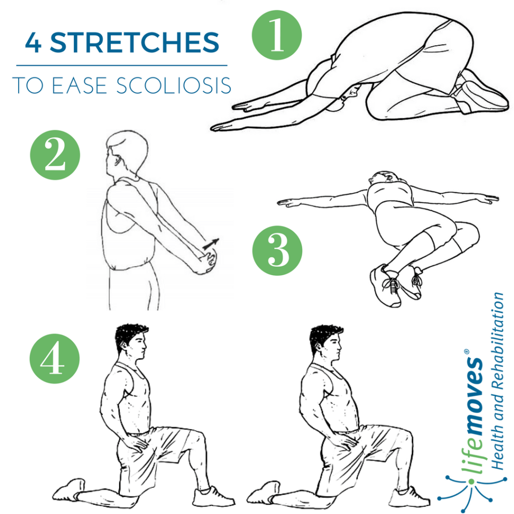 Stretches for Scoliosis
