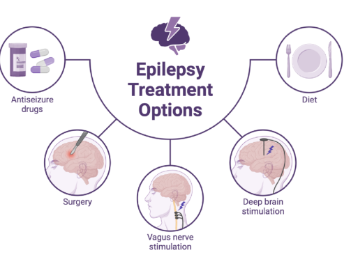 Epilepsy Treatment
