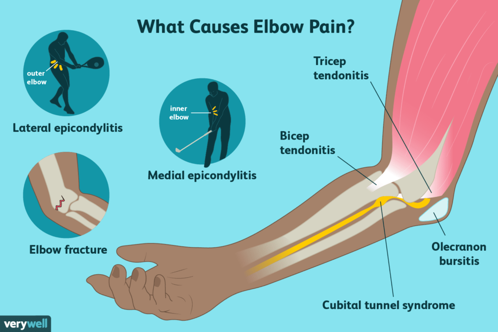 Common Injuries of Elbow Joint